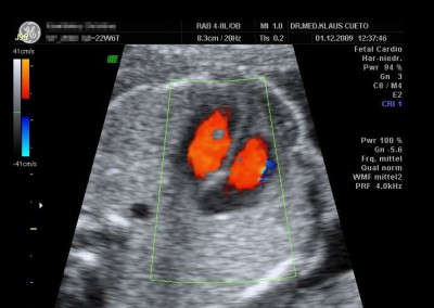 Ultraschall Cueto Fetales Herz